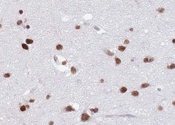 Invitrogen hnRNP C1/C2 Polyclonal Antibody 100 &mu;L; Unconjugated:Antibodies,