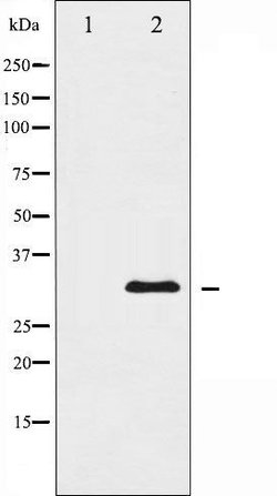 Invitrogen hnRNP C1/C2 Polyclonal Antibody 100 &mu;L; Unconjugated:Antibodies,