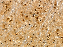 Invitrogen RBMX Polyclonal Antibody 100 &mu;L; Unconjugated:Antibodies,