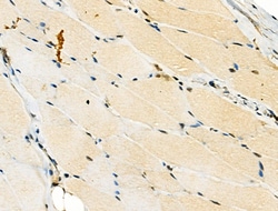 Invitrogen RBMX Polyclonal Antibody 100 &mu;L; Unconjugated:Antibodies,