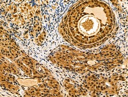 Invitrogen RBMX Polyclonal Antibody 100 &mu;L; Unconjugated:Antibodies,