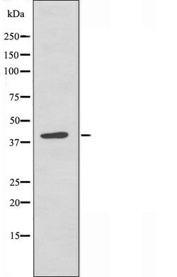 Invitrogen RBMX Polyclonal Antibody 100 &mu;L; Unconjugated:Antibodies,