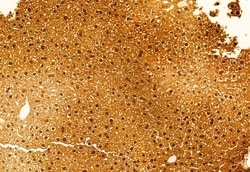 Invitrogen KEAP1 Polyclonal Antibody 100 &mu;L; Unconjugated:Antibodies,