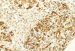 Invitrogen KEAP1 Polyclonal Antibody 100 &mu;L; Unconjugated:Antibodies,