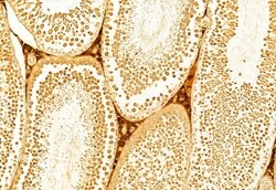 Invitrogen KEAP1 Polyclonal Antibody 100 &mu;L; Unconjugated:Antibodies,