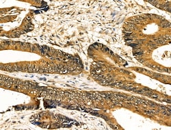 Invitrogen Caspase 8 (Cleaved Asp384) Polyclonal Antibody 100 &mu;L; Unconjugated:Antibodies,