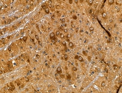 Invitrogen Caspase 8 (Cleaved Asp384) Polyclonal Antibody 100 &mu;L; Unconjugated:Antibodies,
