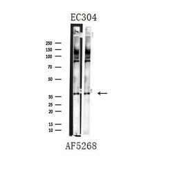 Invitrogen hnRNP A1 Polyclonal Antibody 100 &mu;L; Unconjugated:Antibodies,