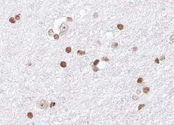 Invitrogen hnRNP A1 Polyclonal Antibody 100 &mu;L; Unconjugated:Antibodies,