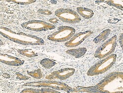 Invitrogen Kir6.2 (KCNJ11) Polyclonal Antibody 100 &mu;L; Unconjugated:Antibodies,