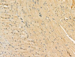 Invitrogen Kir6.2 (KCNJ11) Polyclonal Antibody 100 &mu;L; Unconjugated:Antibodies,