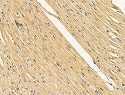 Invitrogen Kir6.2 (KCNJ11) Polyclonal Antibody 100 &mu;L; Unconjugated:Antibodies,