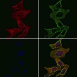 Invitrogen Kir6.2 (KCNJ11) Polyclonal Antibody 100 &mu;L; Unconjugated:Antibodies,