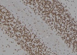 Invitrogen Kir6.2 (KCNJ11) Polyclonal Antibody 100 &mu;L; Unconjugated:Antibodies,