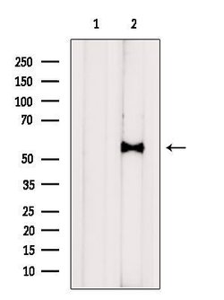 Invitrogen Kir6.2 (KCNJ11) Polyclonal Antibody 100 &mu;L; Unconjugated:Antibodies,