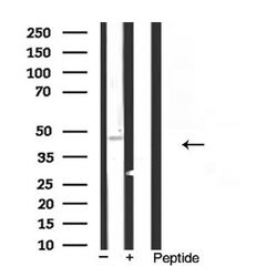 Invitrogen Kir6.2 (KCNJ11) Polyclonal Antibody 100 &mu;L; Unconjugated:Antibodies,