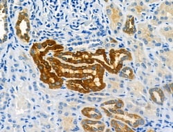 Invitrogen CMKLR1 Polyclonal Antibody 100 &mu;L; Unconjugated:Antibodies,