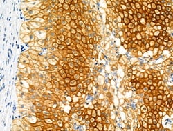 Invitrogen CMKLR1 Polyclonal Antibody 100 &mu;L; Unconjugated:Antibodies,