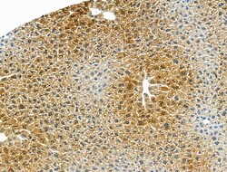 Invitrogen CMKLR1 Polyclonal Antibody 100 &mu;L; Unconjugated:Antibodies,
