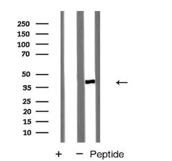 Invitrogen CMKLR1 Polyclonal Antibody 100 &mu;L; Unconjugated:Antibodies,