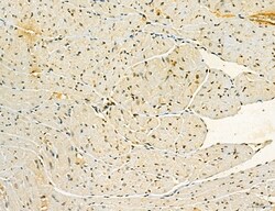 Invitrogen MKL1 Polyclonal Antibody 100 &mu;L; Unconjugated:Antibodies,