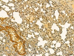 Invitrogen MKL1 Polyclonal Antibody 100 &mu;L; Unconjugated:Antibodies,