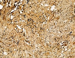 Invitrogen MKL1 Polyclonal Antibody 100 &mu;L; Unconjugated:Antibodies,
