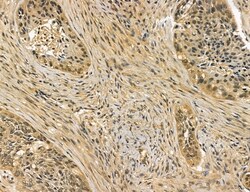 Invitrogen MKL1 Polyclonal Antibody 100 &mu;L; Unconjugated:Antibodies,