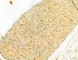 Invitrogen MKL1 Polyclonal Antibody 100 &mu;L; Unconjugated:Antibodies,