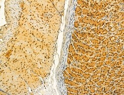 Invitrogen MKL1 Polyclonal Antibody 100 &mu;L; Unconjugated:Antibodies,