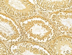 Invitrogen MKL1 Polyclonal Antibody 100 &mu;L; Unconjugated:Antibodies,