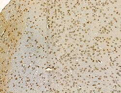 Invitrogen MKL1 Polyclonal Antibody 100 &mu;L; Unconjugated:Antibodies,