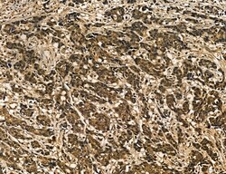 Invitrogen MKL1 Polyclonal Antibody 100 &mu;L; Unconjugated:Antibodies,