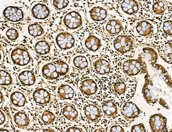 Invitrogen MKL1 Polyclonal Antibody 100 &mu;L; Unconjugated:Antibodies,