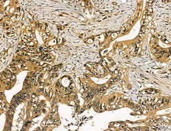 Invitrogen MKL1 Polyclonal Antibody 100 &mu;L; Unconjugated:Antibodies,