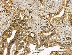 Invitrogen MKL1 Polyclonal Antibody 100 &mu;L; Unconjugated:Antibodies,
