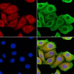 Invitrogen PERK Polyclonal Antibody 100 &mu;L; Unconjugated:Antibodies,