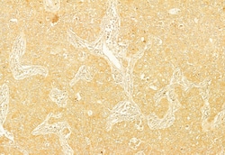 Invitrogen PERK Polyclonal Antibody 100 &mu;L; Unconjugated:Antibodies,