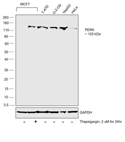 Invitrogen PERK Polyclonal Antibody 100 &mu;L; Unconjugated:Antibodies,