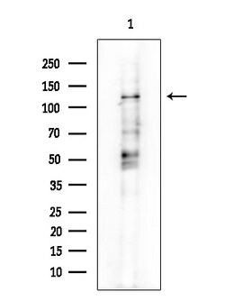 Invitrogen PERK Polyclonal Antibody 100 &mu;L; Unconjugated:Antibodies,