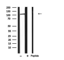 Invitrogen PERK Polyclonal Antibody 100 &mu;L; Unconjugated:Antibodies,
