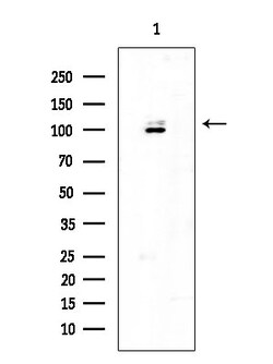 Invitrogen PERK Polyclonal Antibody 100 &mu;L; Unconjugated:Antibodies,