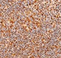 Invitrogen NOTCH1 (Cleaved Val1744) Polyclonal Antibody 100 &mu;L; Unconjugated:Antibodies,
