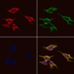 Invitrogen GPR91 Polyclonal Antibody 100 &mu;L; Unconjugated:Antibodies,