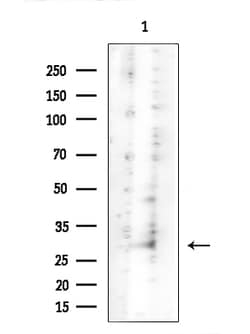 Invitrogen GPR91 Polyclonal Antibody 100 &mu;L; Unconjugated:Antibodies,