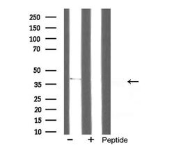 Invitrogen GPR91 Polyclonal Antibody 100 &mu;L; Unconjugated:Antibodies,