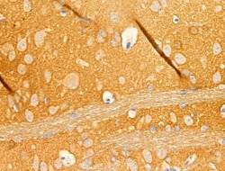 beta Synuclein Polyclonal Antibody:Antibodies, Polyclonal