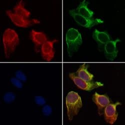 beta Synuclein Polyclonal Antibody:Antibodies, Polyclonal