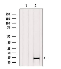 beta Synuclein Polyclonal Antibody:Antibodies, Polyclonal