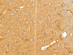 Invitrogen KChIP3 Polyclonal Antibody 100 &mu;L; Unconjugated:Antibodies,